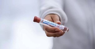 Δωρεάν Rapid test COVID-19 στο Δήμο Διστόμου-Αράχωβας-Αντίκυρας