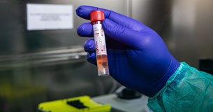 Κορωνοϊός: Έγκυος γυναίκα στο Hot Spot Ριτσώνας διαγνώστηκε τον ιό