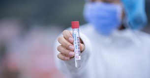 Γρήγορα τεστ κορωνοϊού στο Δήμο Δελφών